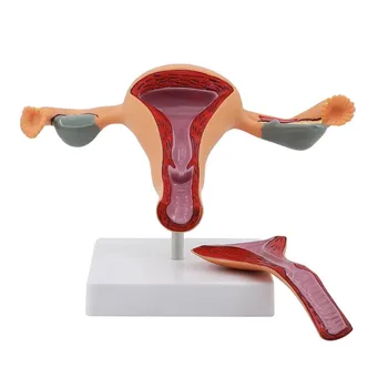 Модели сексуальных женских органов Анатомическая модель женского репродуктивного органа Матка Влагалище, модель женской матки